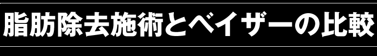 ベイザーとの比較