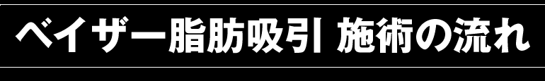ベイザー脂肪吸引 施術の流れ